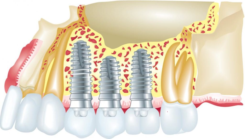 Minor and Major Oral surgery