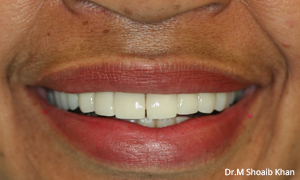 arlington heights after dental treatment