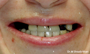 before dental arlington heights