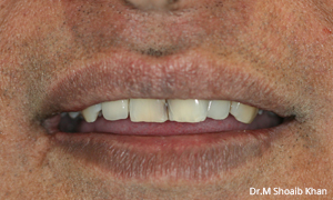 before and after dental arlington heights