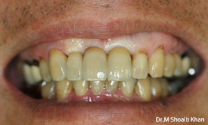 after treatment dental arlington heights