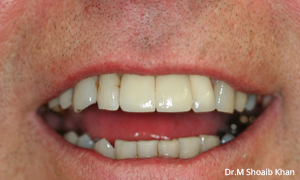 after dental arlington heights