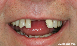 before and after dental arlington heights