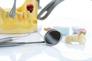 Fillings-Crowns-Bridges