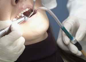 dental exam