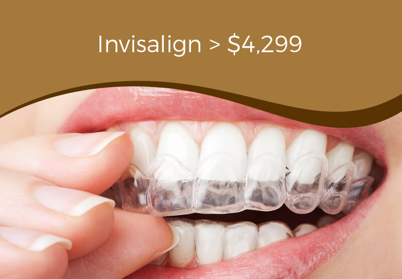 invisalign special offer