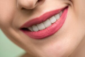 improve-the-appearance-of-your-smile-with-professional-teeth-whitening